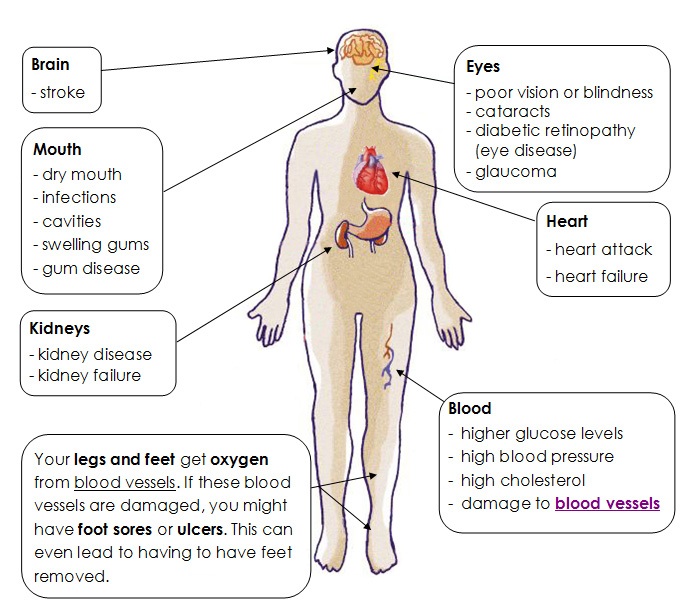 effects of Diabetes